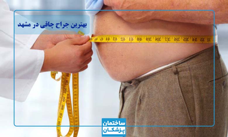 بهترین جراح چاقی در مشهد