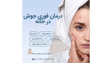 از بین بردن جوش صورت در یک روز