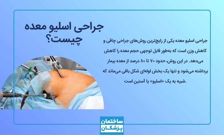 جراحی اسلیو معده چیست