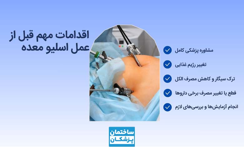 قبل از عمل اسلیو معده در مشهد چه کارهایی انجام دهیم