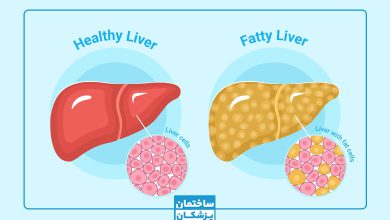 کبد چرب - علائم درمان و پیشگیری