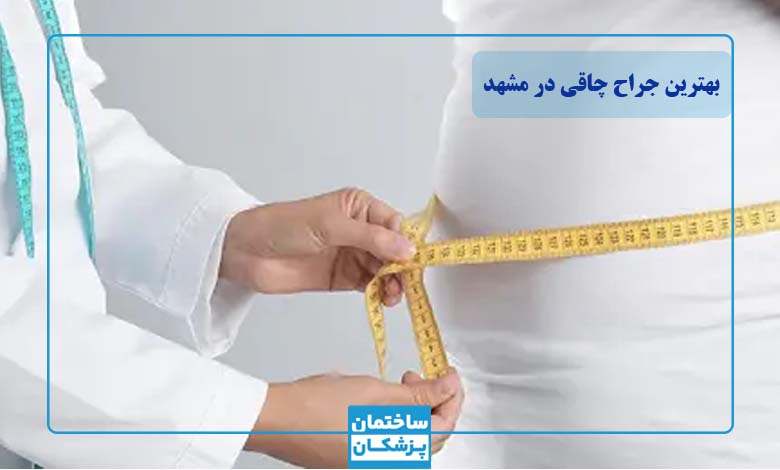 جراحی چاقی در مشهد