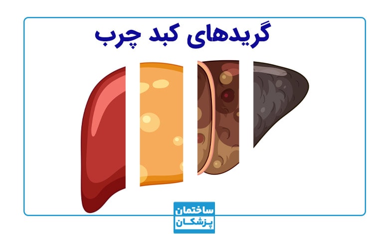 عوارض کبد چرب + گریدهای کبد چرب