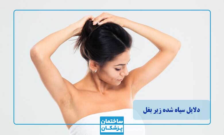 چرا زیر بغل سیاه میشود؟