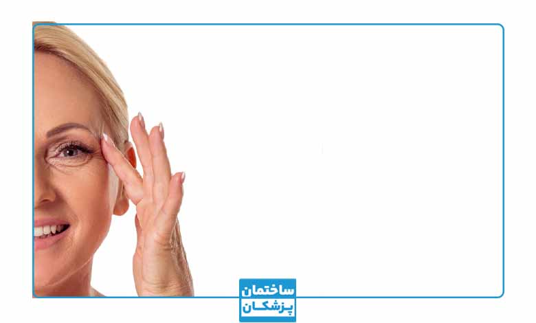 ماندگاری بوتاکس چشم گربه ای چقدر است؟