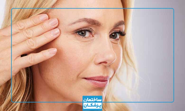 بوتاکس چشم گربه ای بعد از چند روز اثر میکند؟