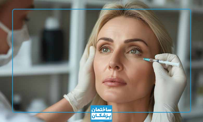 نقاط تزریق بوتاکس چشم گربه ای