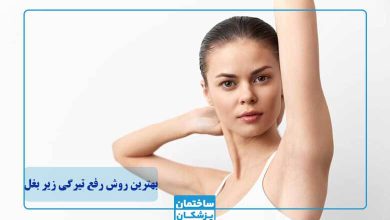 بهترین روش رفع تیرگی زیر بغل چیست؟