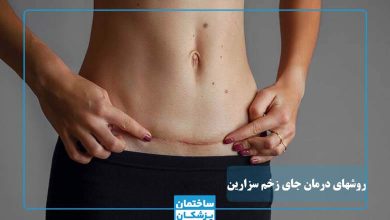 بهترین روش درمان جای زخم سزارین چیست؟