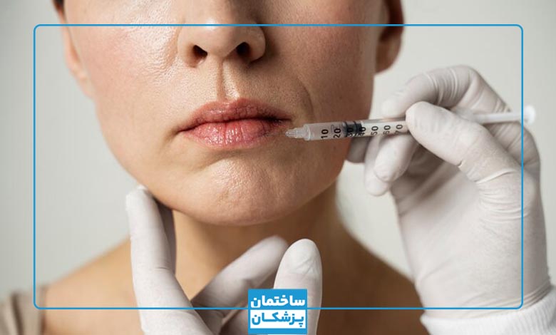بهترین دکتر بوتاکس در سنندج چه کسی است؟