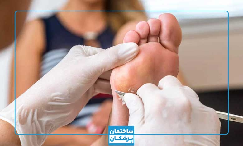 در انتخاب بهترین دکتر درمان میخچه به چه نکاتی توجه کنیم؟