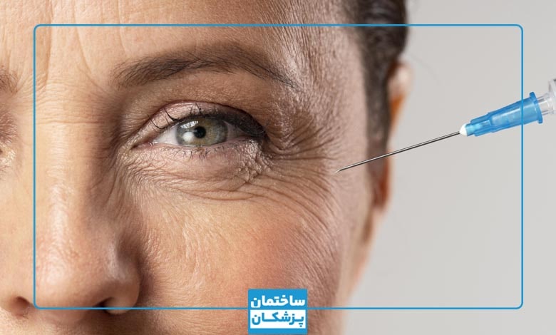 معیارهای مهم در انتخاب بهترین دکتر بوتاکس در مهاباد