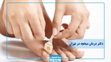 بهترین دکتر درمان میخچه در تهران