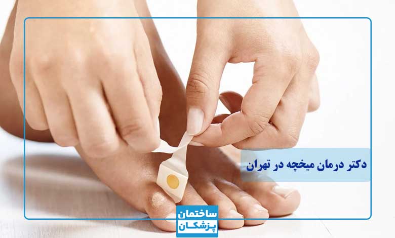 بهترین دکتر درمان میخچه در تهران