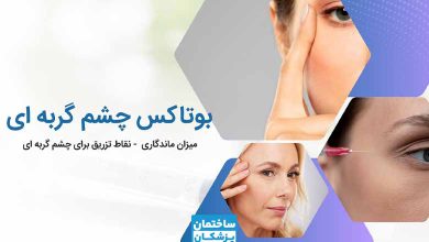بوتاکس چشم گربه ای