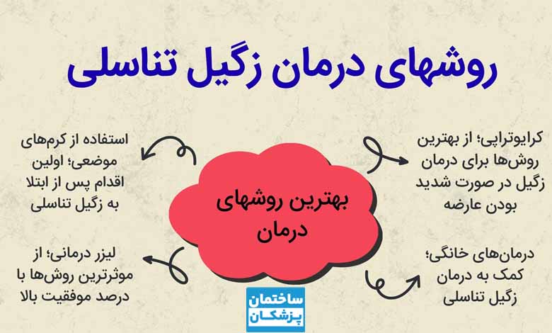 روشهای درمان زگیل تناسلی