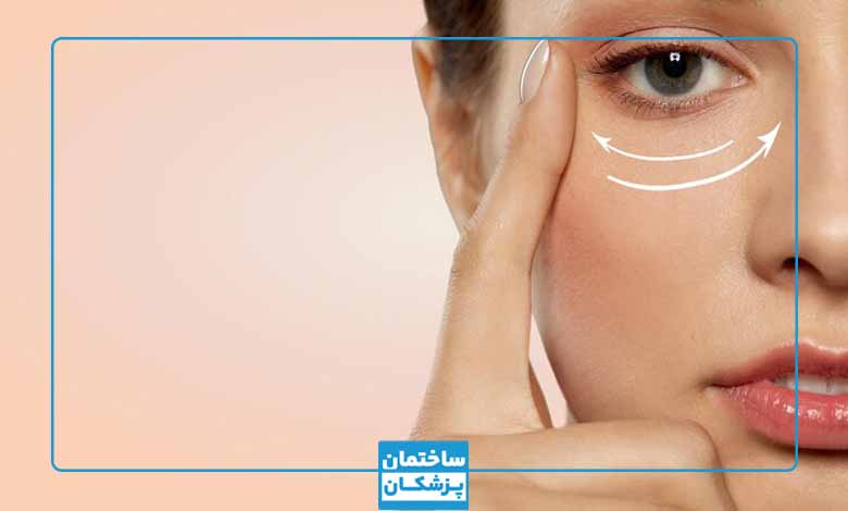 بوتاکس چشم گربه ای چیست