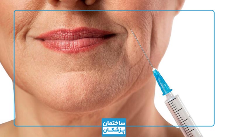 معیارهای مهم در انتخاب بهترین دکتر بوتاکس در سنندج