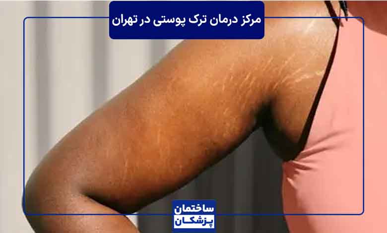 هزینه درمان ترکهای پوستی در تهران چقدر است؟