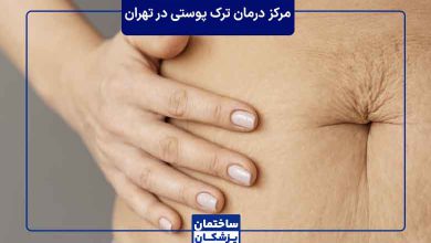 بهترین مرکز درمان ترک پوستی در تهران