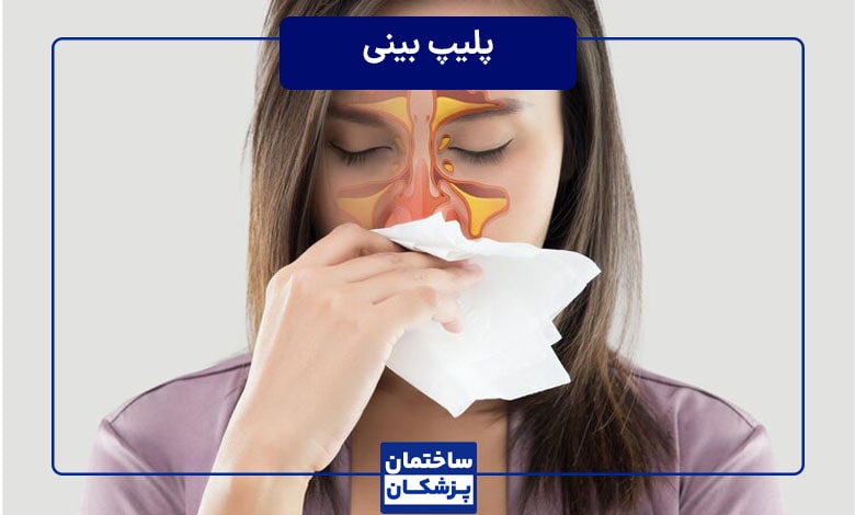 از کجا بفهمیم پلیپ بینی داریم