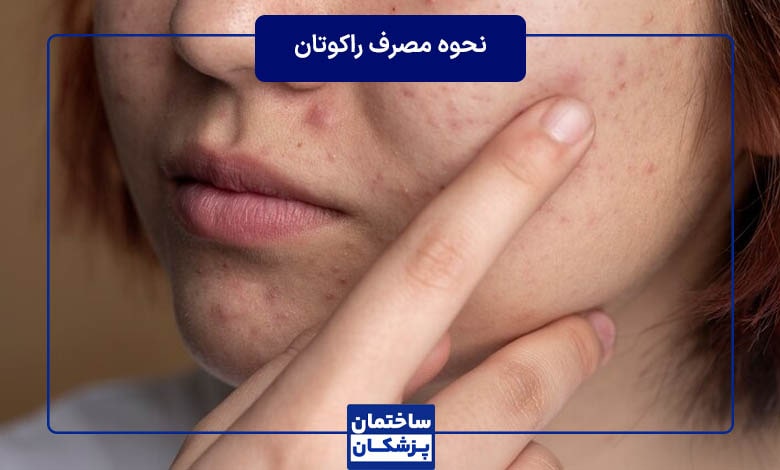 نحوه مصرف راکوتان