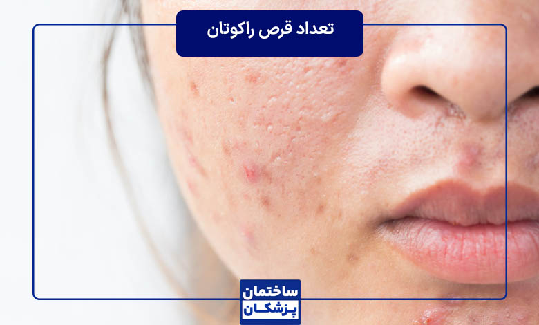 چند عدد راکوتان در روز باید بخورم؟