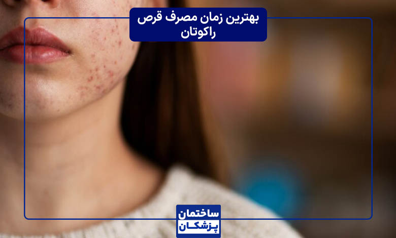بهترین زمان مصرف قرص راکوتان