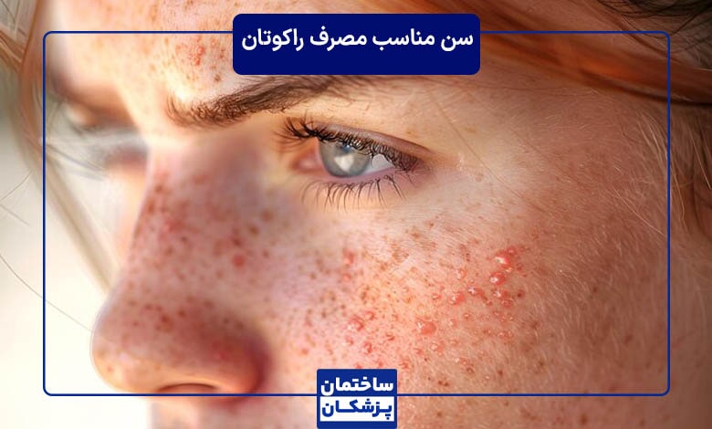 قرص راکوتان مناسب چه سنی است؟