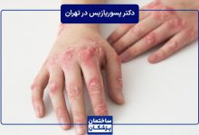 بهترین دکتر پسوریازیس در تهران