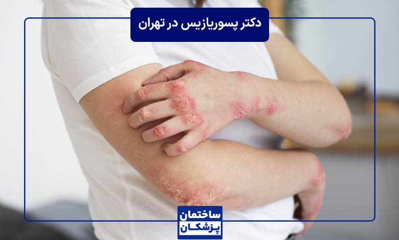 بهترین روشهای درمان پسوریازیس چیست؟