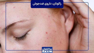 راکوتان، قویترین داروی ضدجوش
