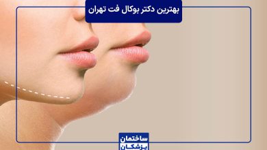 بهترین دکتر بوکال فت در تهران