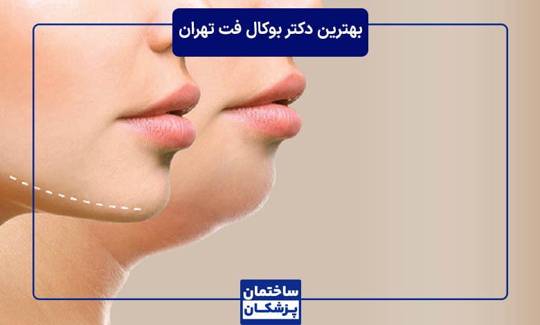 بهترین دکتر بوکال فت در تهران