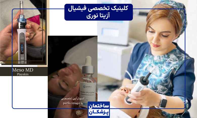 مواد مصرفی در فیشیال در مرکز فیشیال آزیتا نوری