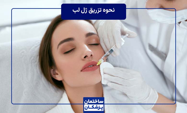 نحوه تزریق ژل لب توسط پزشک حرفه ای