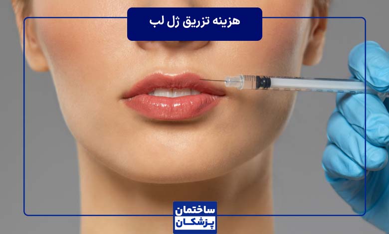 هزینه تزریق ژل لب چقدر است + عوامل موثر بر هزینه