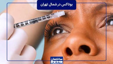 معرفی بهترین دکتر بوتاکس در شمال تهران
