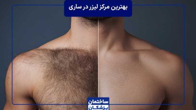 لیست بهترین مرکز لیزر در ساری