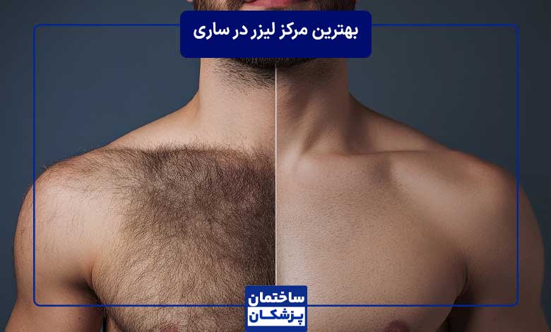 لیست بهترین مرکز لیزر در ساری