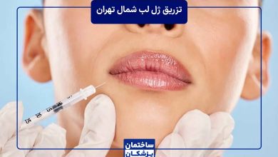 معرفی بهترین دکتر تزریق ژل لب در شمال تهران