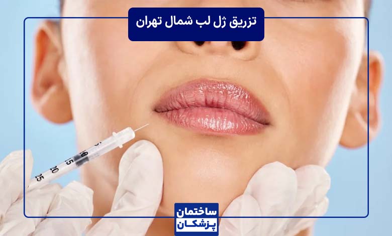 معرفی بهترین دکتر تزریق ژل لب در شمال تهران