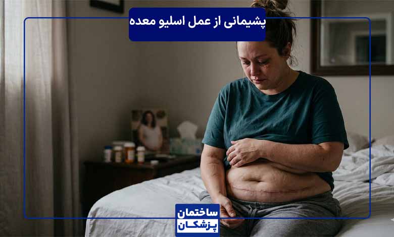شدن شدن و افتادگی پوست بعد از عمل اسلیو معده