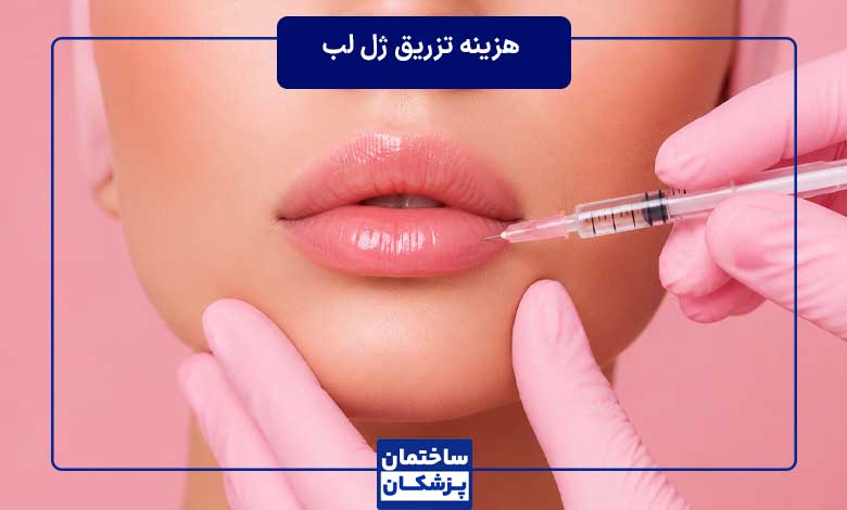 هزینه هر سی سی ژل لب در تهران