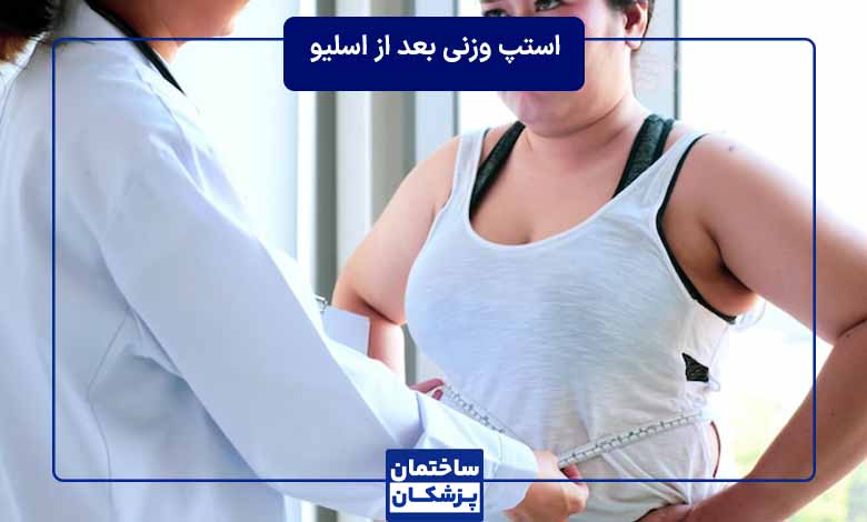 استپ وزنی بعد از عمل اسلیو معده