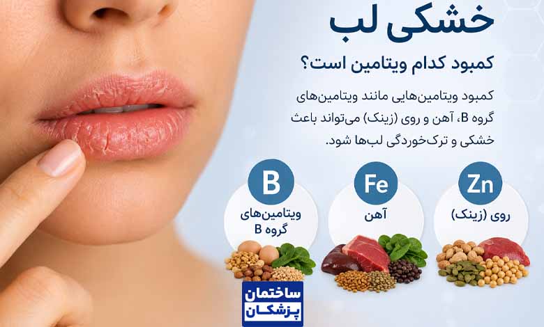 کمبود کدام ویتامین باعث خشکی لب میشود؟
