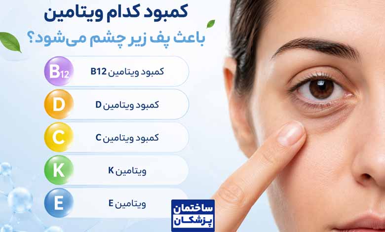کمبود چه ویتامینی باعث پف زیر چشم میشود