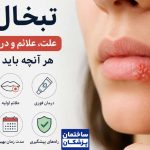 علت تبخال لب چیست؟ + روشهای درمان