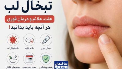 علت تبخال لب چیست؟ + روشهای درمان