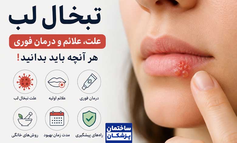 علت تبخال لب چیست؟ + روشهای درمان